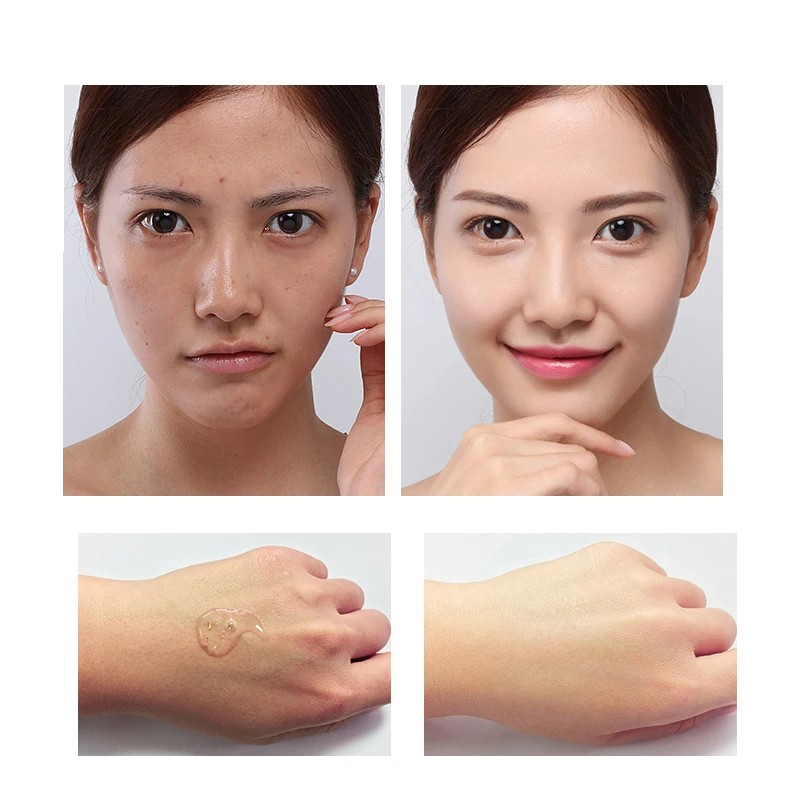 Сыворотка для лица отбеливание ярче питательная гиалуроновая Успокаивающая