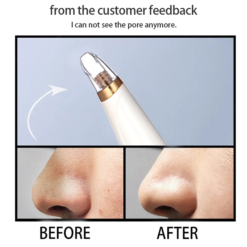 Средство для удаления черных точек лица глубокое Удаление пор скруббер кожи