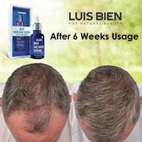 luis bien fast hair growth serum essential oil blue serum anti hair loss liquid hair growth treatment for men women hair care