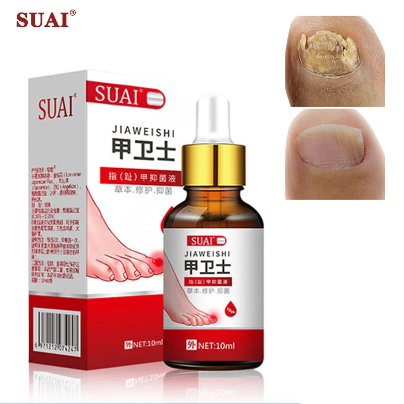 

Nail Fungal Treatment Feet Care Essence Nail Foot Whitening Toe Nail Fungus Removal Gel Anti Infection Paronychia Onychomycosis