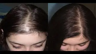 

care health beauty hair roots garlic extract anti-dandruff hair removal natural organic shampoo