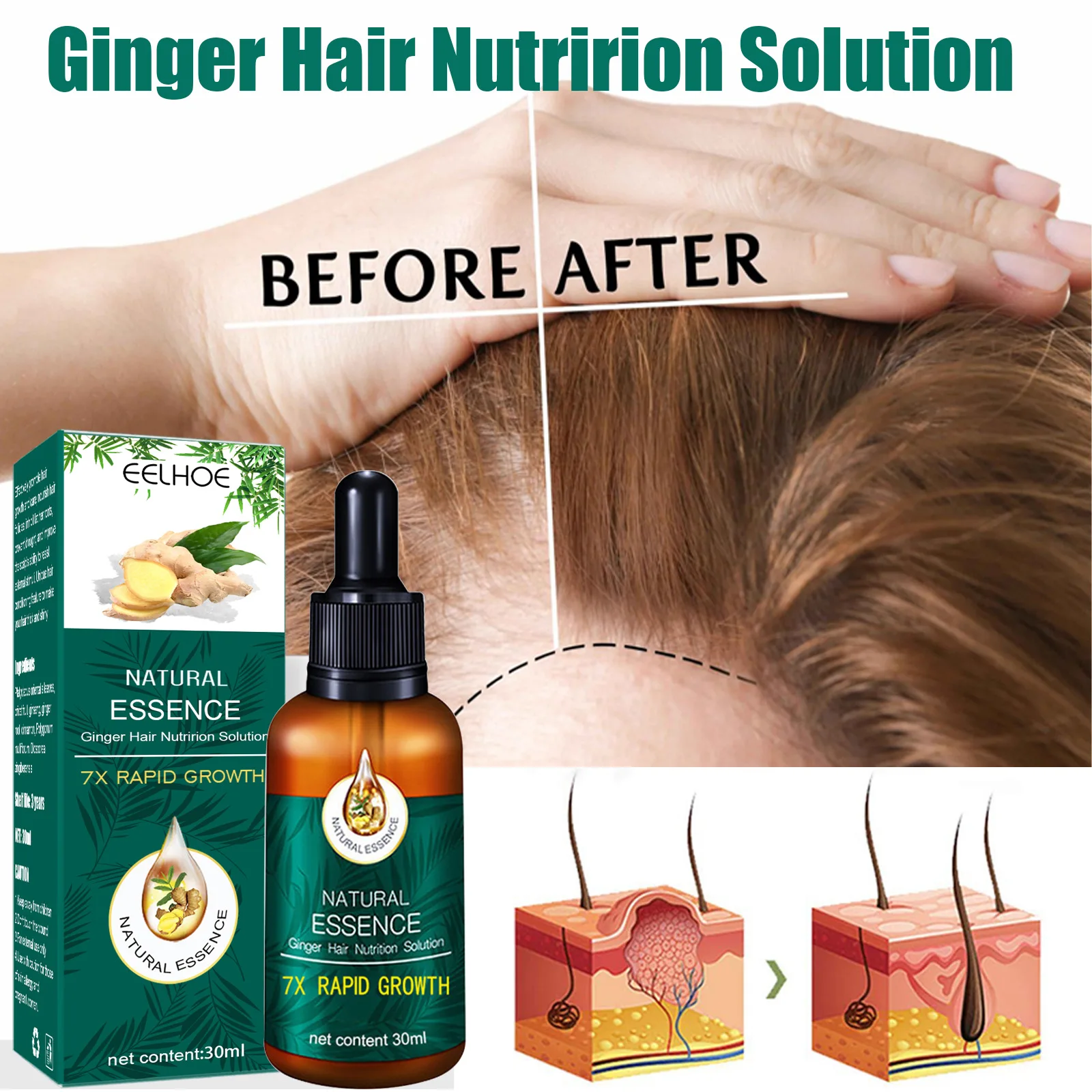 

Hair Care Ginger Hair Growth Essential Oil Serum Hair Treatment Anti Lost Beauty Products Fast Grow Repair Scalp Frizzy Damaged
