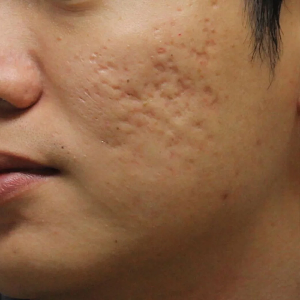 Expigment 30 г крем магический эффект центелла asiatica клеток регенератора акне травма