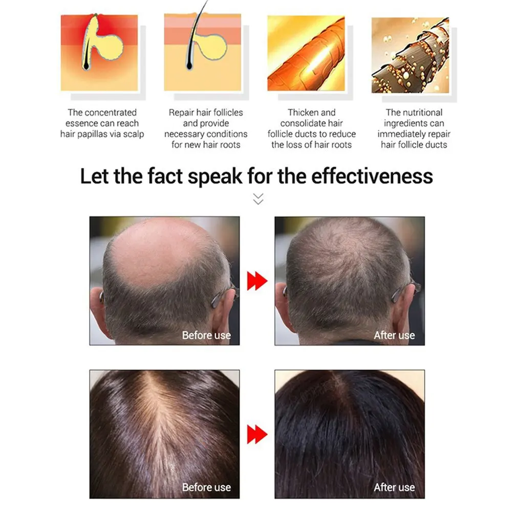 Hair Growth Essential Oil Care 20ml Liquid Loss Treatment Promote | Красота и здоровье