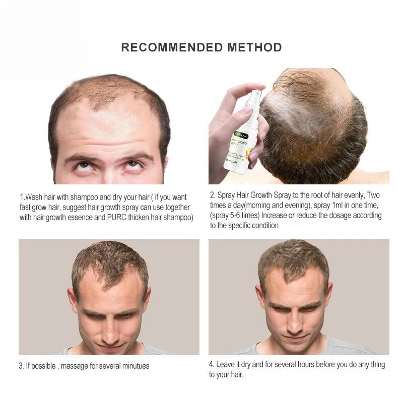 Имбирная сыворотка-спрей для роста волос натуральная Сыворотка против выпадения