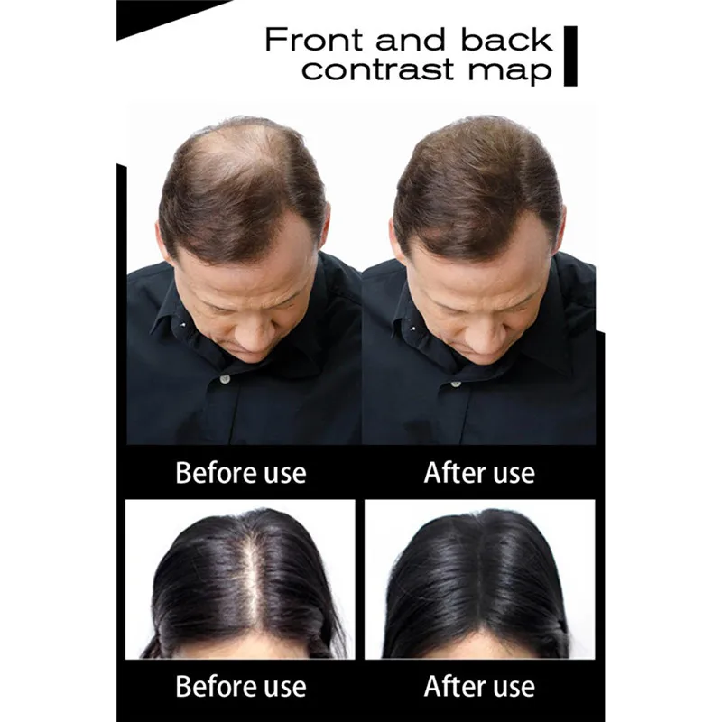 Новинка 2019 пудра для наращивания волос продукты выпадения спрей утолщения