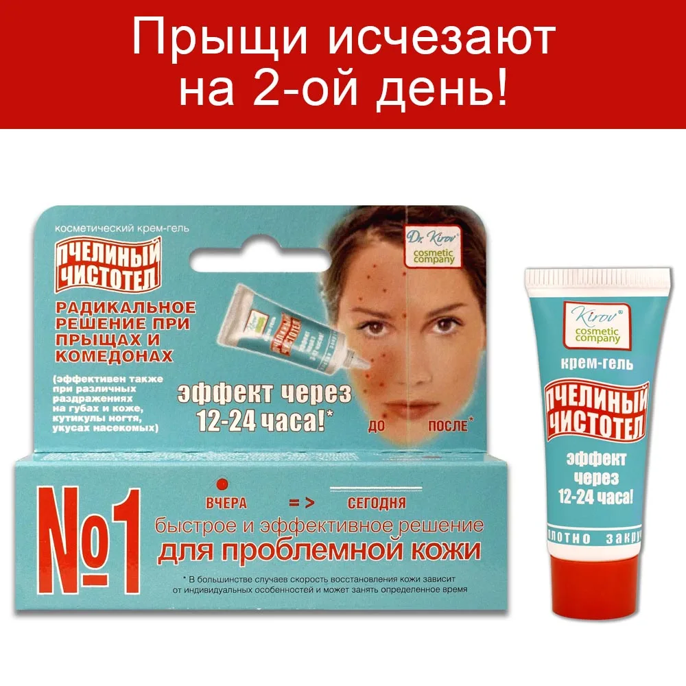 Крем от прыщей угрей черных точек и комедонов Пчелиный чистотел гель. Средство