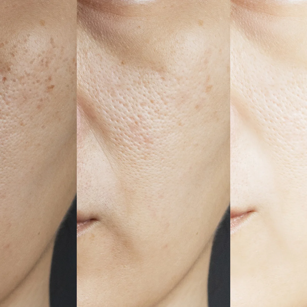 Прихватка для удаления загара шелковая искусственная кожа тела лица 2 в 1