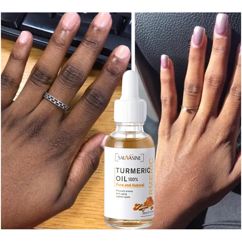 

Turmeric Lemon Oil Skin Glow To Lightening Acne Dark Patches, Acne Bright Skin Dark Spot Corrector Face Whitening Serum 30ml