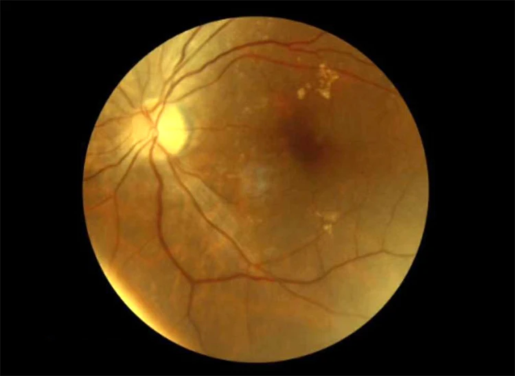 Дешевая Портативная портативная фотокамера NFC по низкой цене из Китая|Запчасти и