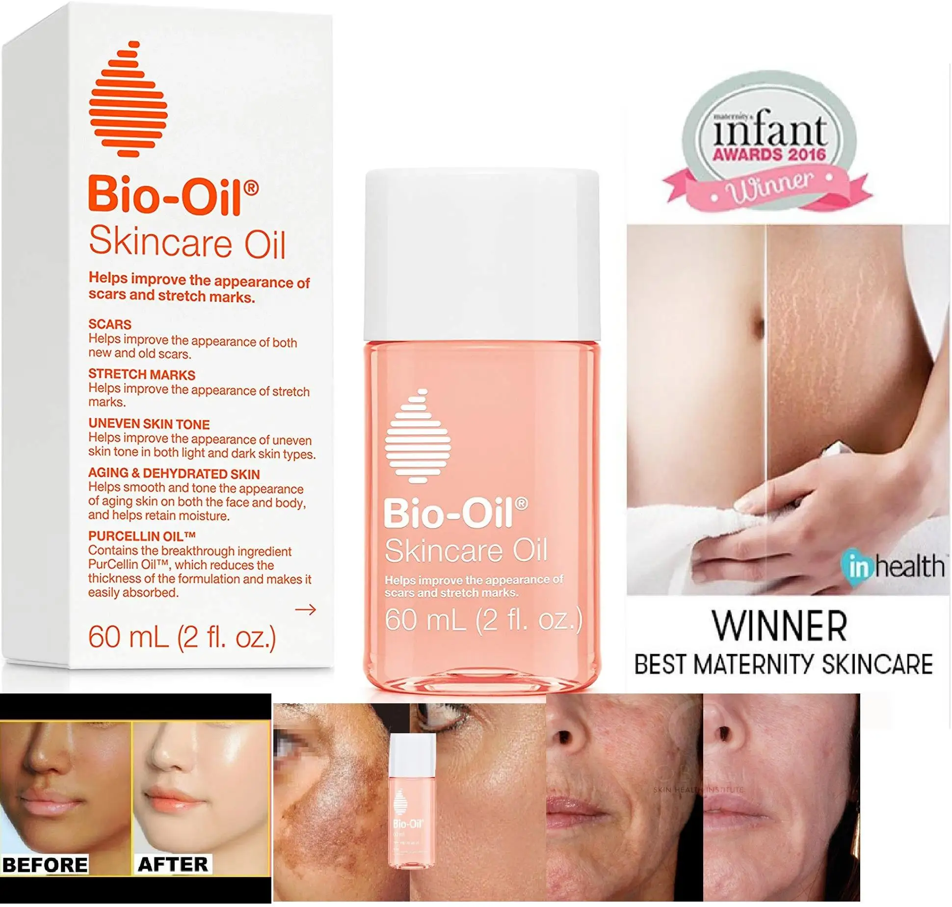 Bio-Oil Skin Care Oil Reduction in Stretch Marks in 8 Weeks 125ml X 2 PCS enlarge