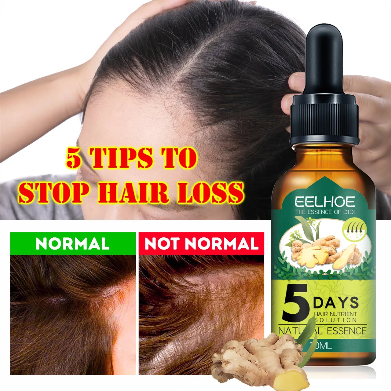 

Hair Care Hair Growth Essential Oils Essence Original Authentic Hair Loss Treatment Hair Regrowth In 5 Days Hair Growth Serum