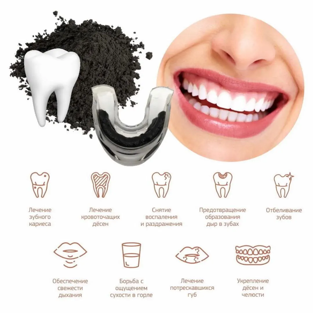 Схема капы. Капа для отбеливания зубов. My Brilliant smile капы. Каппа для зубов для отбеливания зубов. Зубные капы для отбеливания.