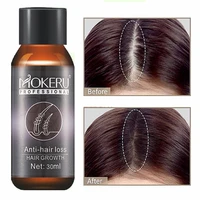 powerful hair growth oil prevent hair loss products essence liquid treatment for men and women repair shampoo hair care