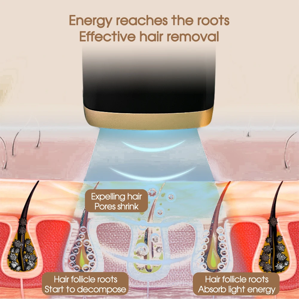 IPL-эпилятор [ZS] для мужчин и женщин устройство безболезненного удаления волос на