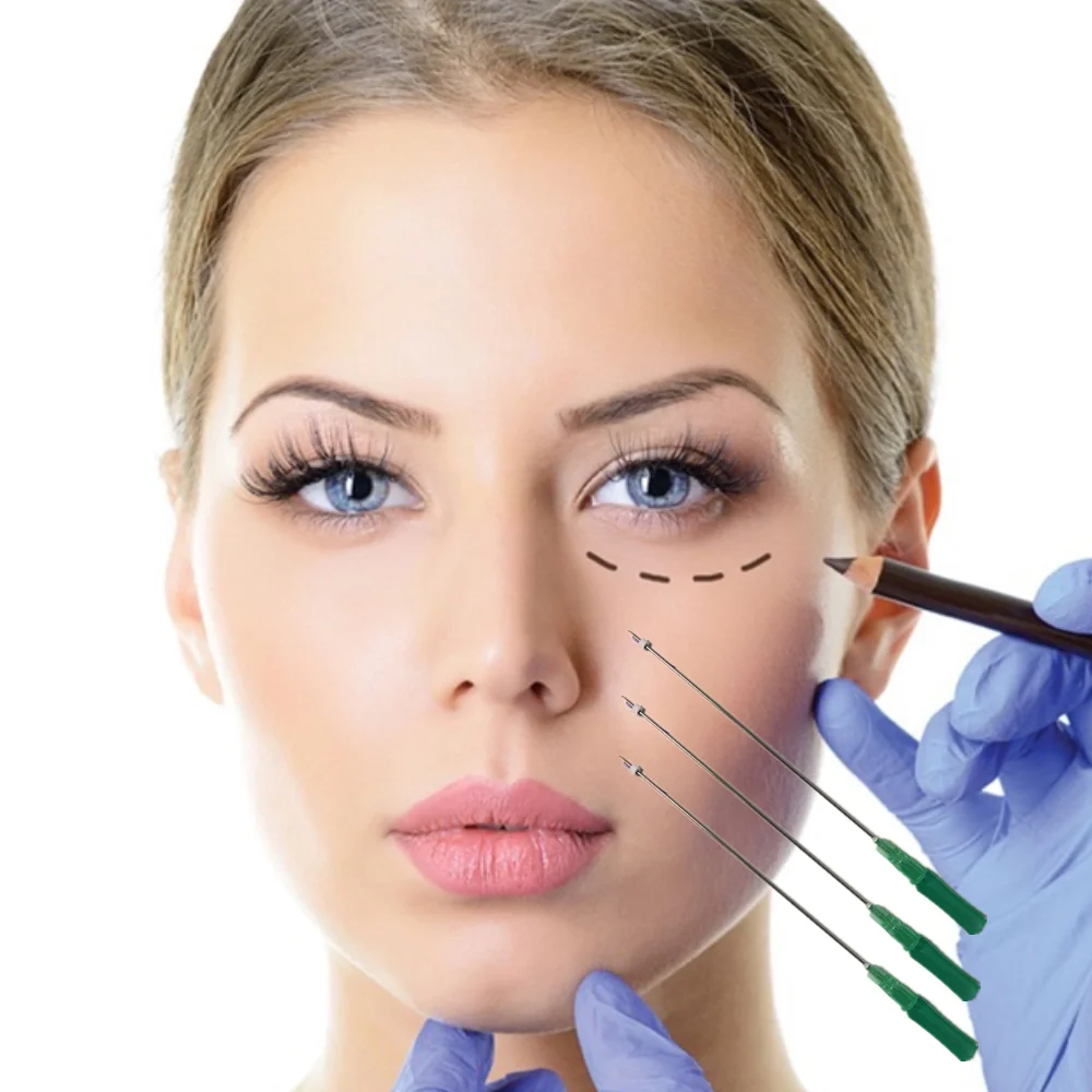 Косметическая хирургия для подтяжки кожи молдинг ПДО рыбья кость лица и тела с